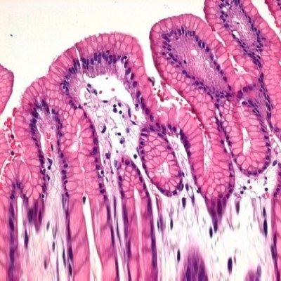 EOSIN Y-SOLUTION 0.5% ALCOHOLIC