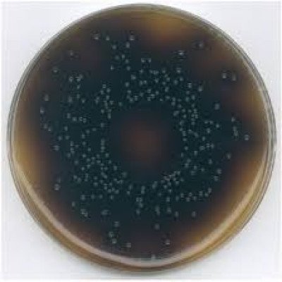 OXFORD LISTERIA SELECTIVE AGAR (BASE)