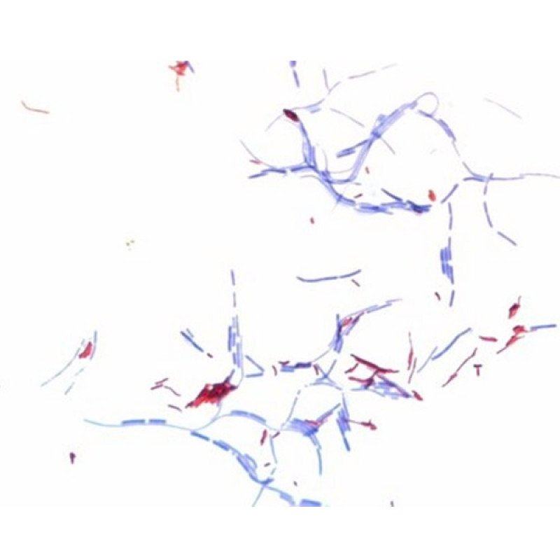 ZIEHL-NEELSEN CARBOL-FUCHSIN SOLUTION FO 2.5 L