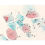 Shorr staining solution 500 ML
