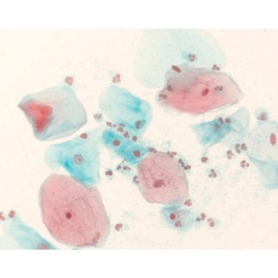 Shorr staining solution 500 ML