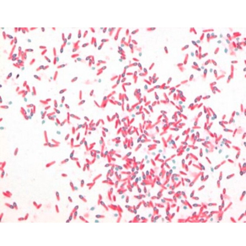 AFB-Color malachite green (oxalate) solu 500 G