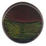 EMB AgarNutriSelect Plus 500 G