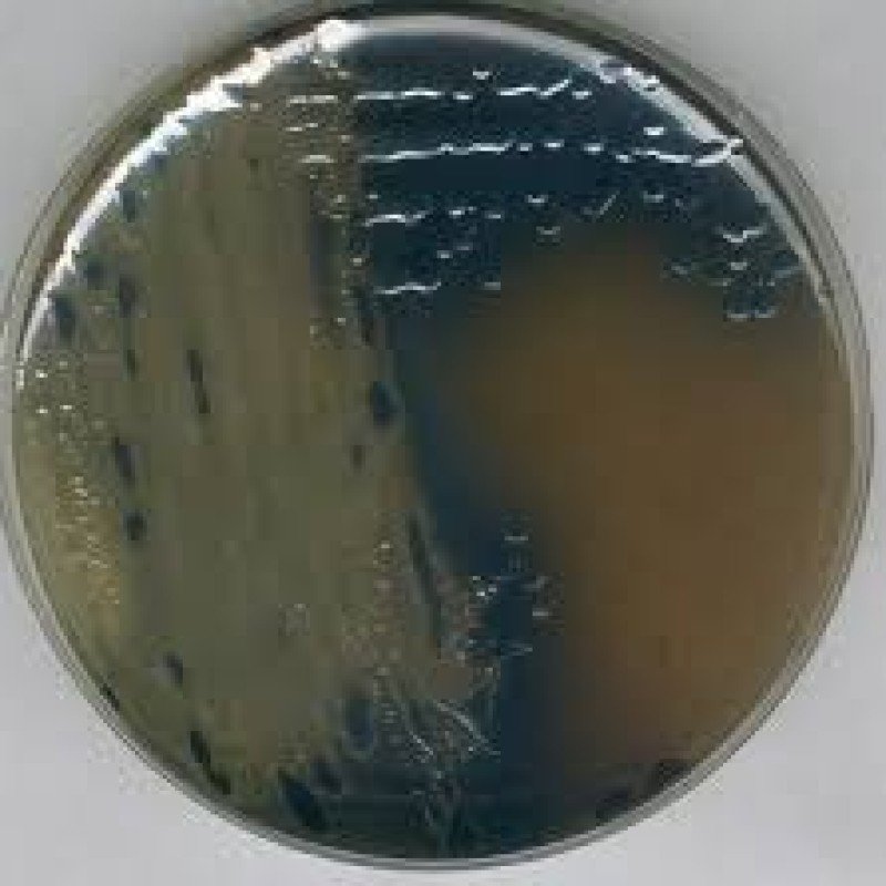 Bismuth Sulfite Agar WILSON-BLAIR