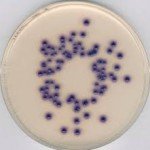 CHROMOCULT COLIFORM AGAR ES