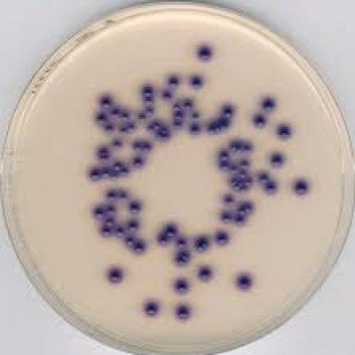 CHROMOCULT COLIFORM AGAR ES