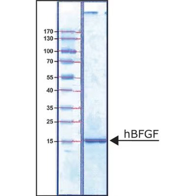 FIBROBLAST GROWTH FACTOR-BASIC HUMAN& 25 UG