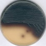 KANAMYCIN ESCULIN AZIDE AGAR FOR MICROBIOLOGY