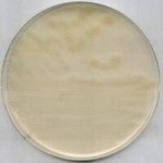 R2A AGAR FOR MICROBIOLOGY