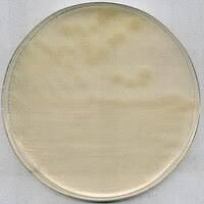 R2A AGAR FOR MICROBIOLOGY