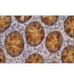 MONOCLONAL ANTI-BLOOD GROUP LEWIS A